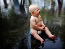 US infant formula recall expanded amid widening infant botulism outbreak