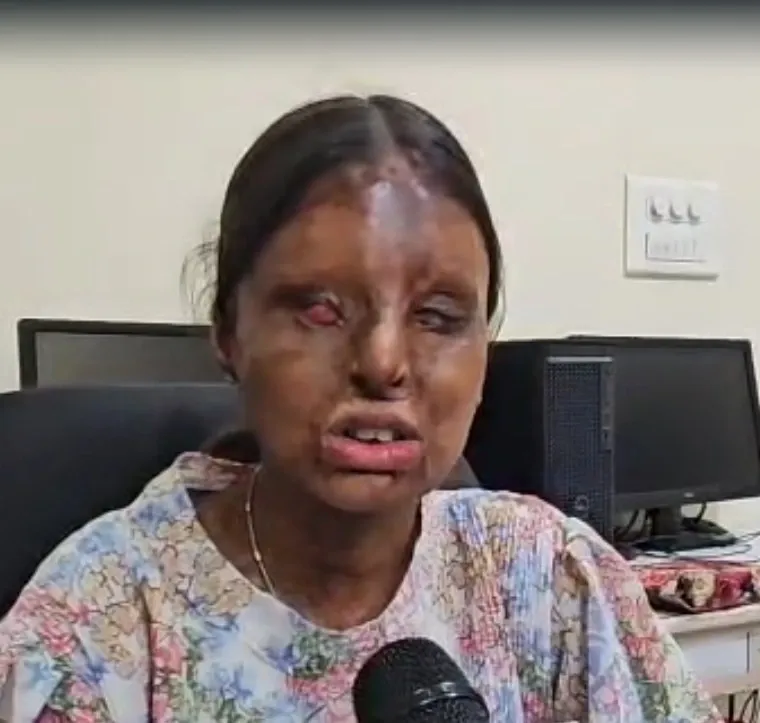 How Did Chandigarh Acid Attack Survivor Kafi Achieve 95.6% in CBSE Class 12?