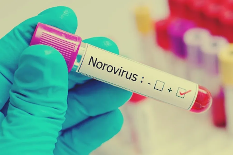 UK Health Officials Alert Citizens to Possible Second Norovirus Wave