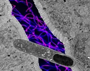 US researchers find gut bacteria that can help lose weight, boost metabolic health