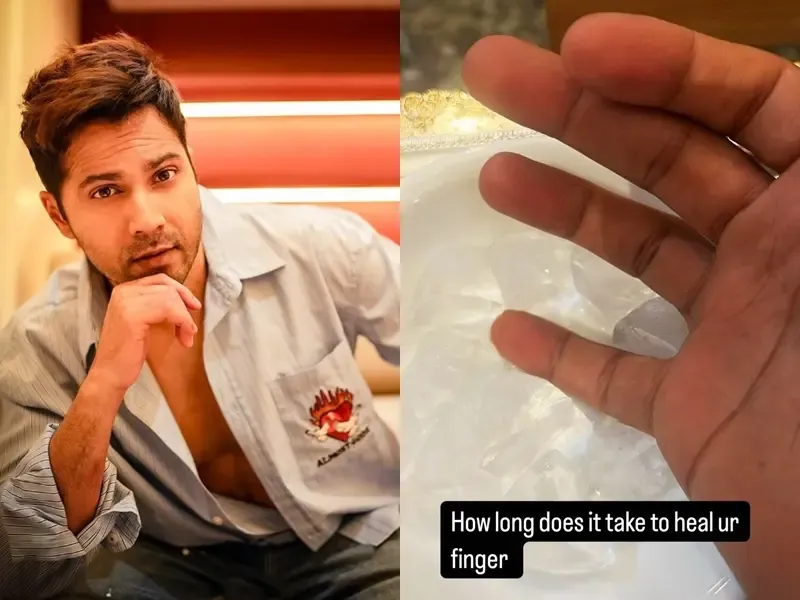 Varun Dhawan suffers a ‘work injury’, inquires about healing time
