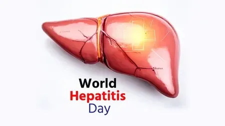 विश्व हेपेटाइटिस दिवस : 'साइलेंट किलर' से सावधान, जागरूकता है उपाय