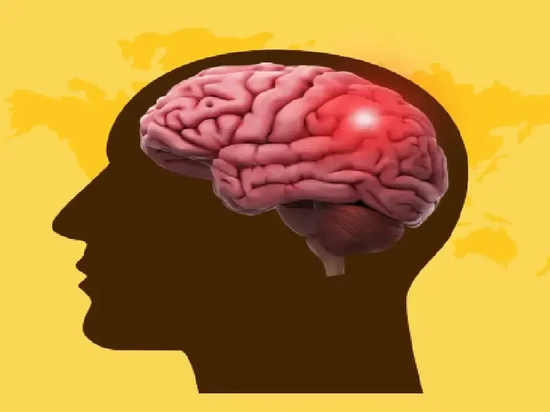 क्या आप जानते हैं विश्व स्ट्रोक दिवस 2025 पर ब्रेन स्ट्रोक से बचने के लिए जीवनशैली में कैसे बदलाव करें?