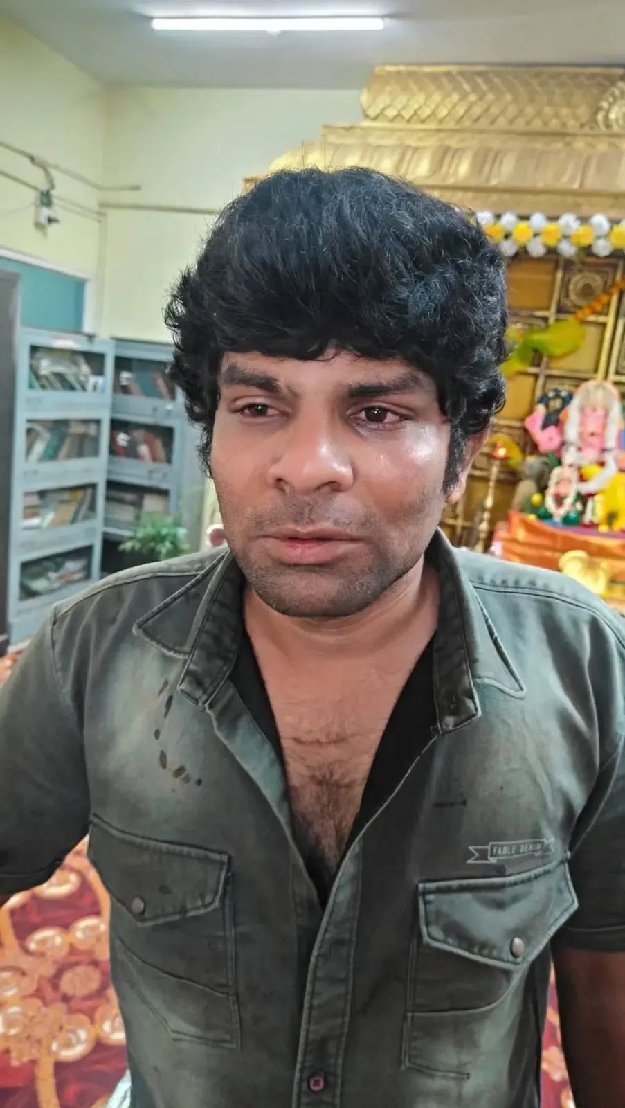 Bengaluru nurse Madhumita critical in ICU after husband's acid, machete attack near hospital