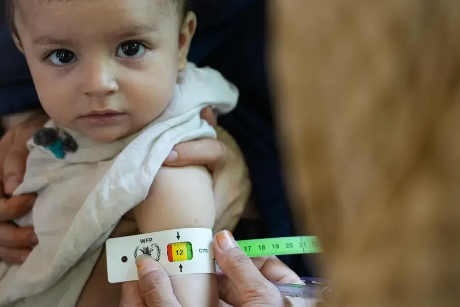 WFP Raises Alarm as 3.5 Million Afghan Children Face Malnutrition in 2025