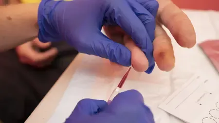 Is This the First Fingerstick Test to Improve Hepatitis B Diagnosis Access?